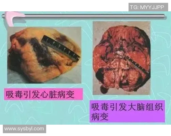 足球明星吸毒丑闻揭秘盘点那些曾因毒品而饱受争议的球员们